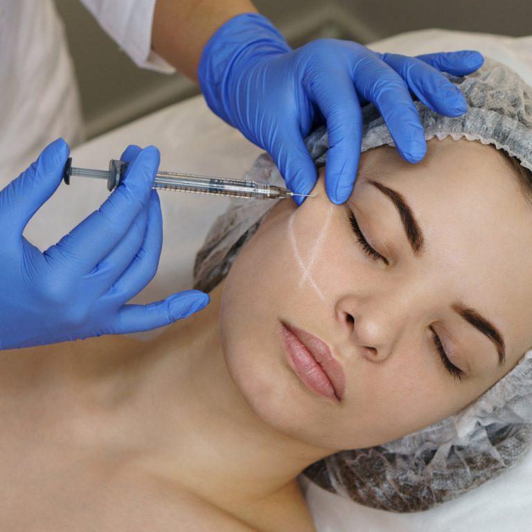 acido-hialuronico-rellenos relleno facial con ácido hialurónico