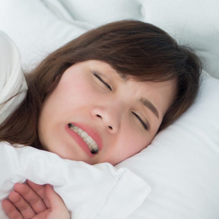 bruxismo-02 tratamiento del bruxismo en madrid