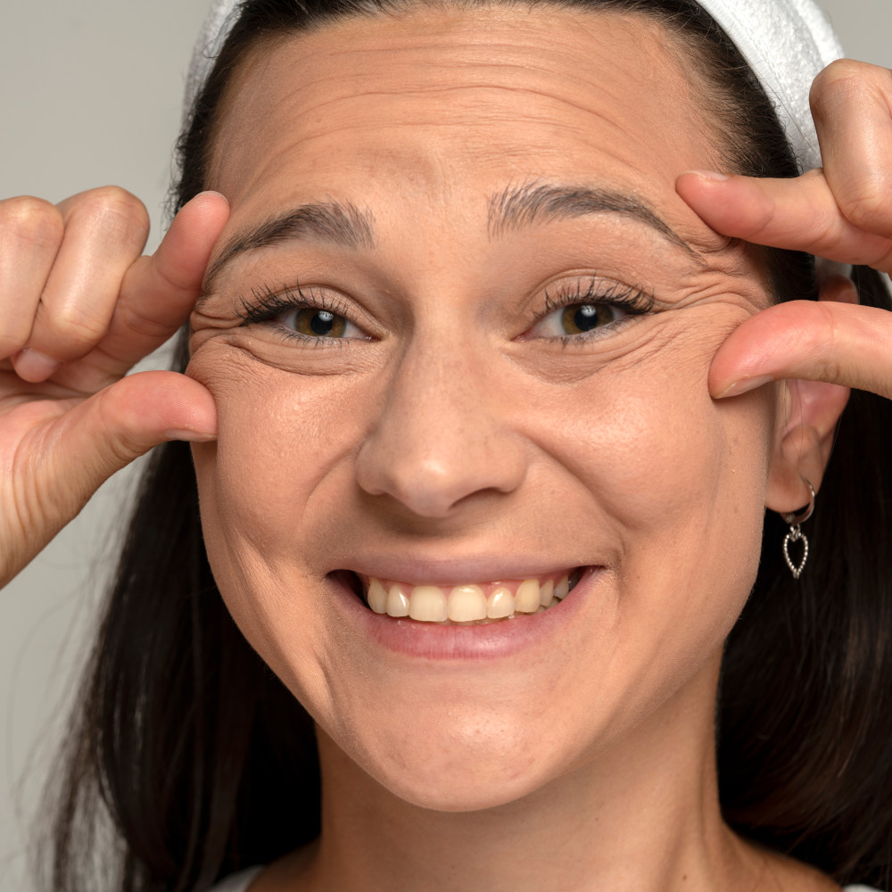 tratamiento arrugas faciales
