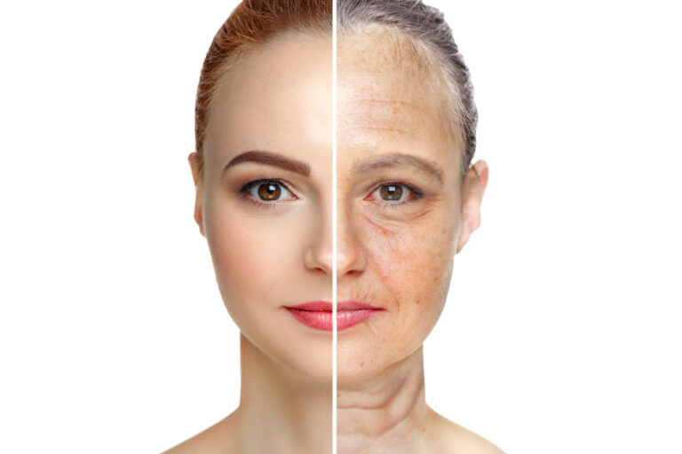 Cómo envejece el rostro de una mujer con la edad