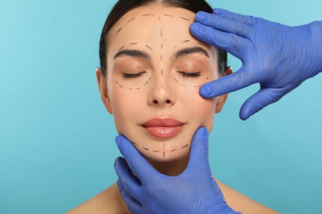qué zonas del rostro mejoran con la armonización facial